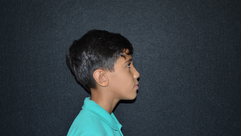 A formação de excelência em otoplastia, com prática supervisionada, é analisada por Dr. Milton Seigi Hayashi.