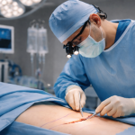 A miniabdominoplastia é indicada quando a flacidez é localizada e o plano cirúrgico precisa ser preciso, afirma Haeckel Cabral Moraes.