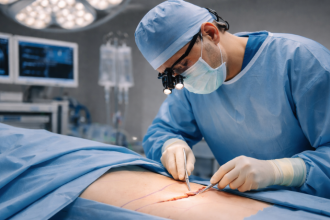 A miniabdominoplastia é indicada quando a flacidez é localizada e o plano cirúrgico precisa ser preciso, afirma Haeckel Cabral Moraes.