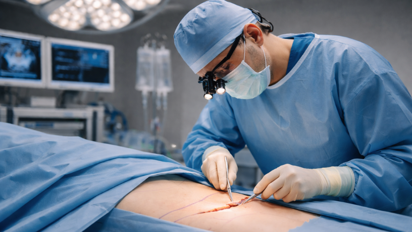 A miniabdominoplastia é indicada quando a flacidez é localizada e o plano cirúrgico precisa ser preciso, afirma Haeckel Cabral Moraes.